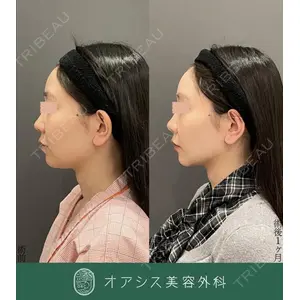 オアシス美容外科 遠藤 剛史医師の症例
