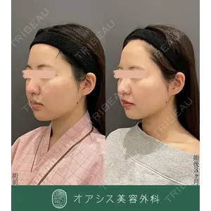オアシス美容外科 遠藤 剛史医師の症例