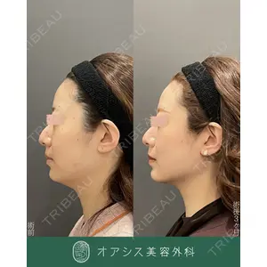 オアシス美容外科 遠藤 剛史医師の症例