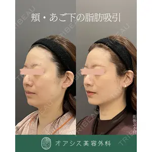 オアシス美容外科 遠藤 剛史医師の症例