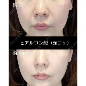 HAAB CLINIC 福岡院 北村 可恋医師の症例
