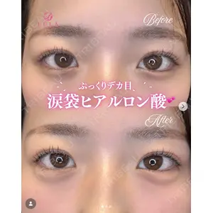 ルラ美容クリニック 大阪心斎橋院の症例