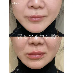 アデル美容クリニック 青柳 慶憲医師の症例