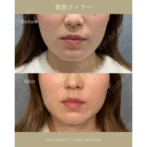 ルラ美容クリニック 岡山院 橋本 晃典医師の症例