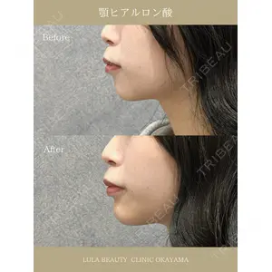 ルラ美容クリニック 岡山院 橋本 晃典医師の症例