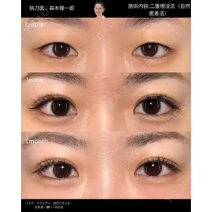PRISM Beauty Clinic 町田院 森本 理一郎医師の症例