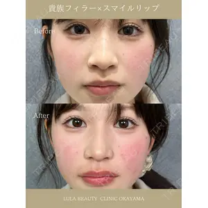 ルラ美容クリニック 岡山院 橋本 晃典医師の症例