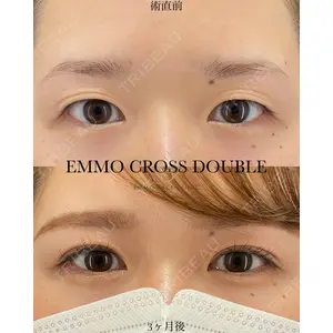 EMMO FACE CLINIC 大宮院 廣松 直樹医師の症例