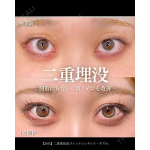 東京シンデレラ美容外科 大宮院 竹田 昌平医師の症例