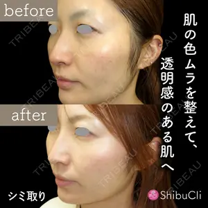 渋谷美容外科クリニック 渋谷院の症例