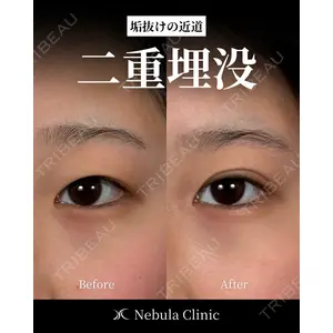 愛知春日井美容外科ネビュラクリニック 都築 諒医師の症例