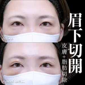 EMMO FACE CLINIC 大宮院 百瀬 直也医師の症例