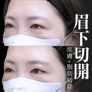 EMMO FACE CLINIC 大宮院 百瀬 直也医師の症例