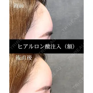HAAB CLINIC 福岡院 北村 可恋医師の症例