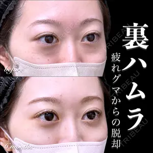 EMMO FACE CLINIC 大宮院 百瀬 直也医師の症例