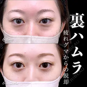 EMMO FACE CLINIC 大宮院 百瀬 直也医師の症例