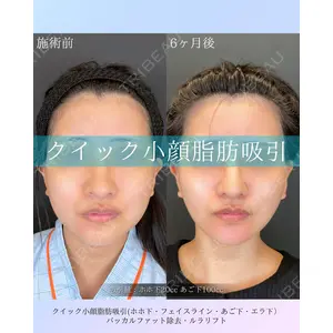 ルラ美容クリニック 札幌本院 佐藤 雄紀医師の症例