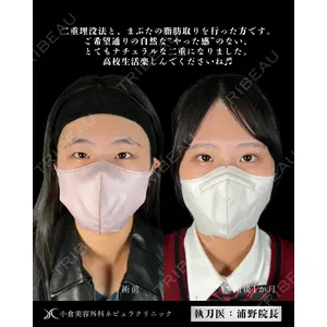 小倉美容外科ネビュラクリニック 浦野 正樹医師の症例