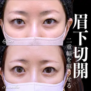 EMMO FACE CLINIC 大宮院 百瀬 直也医師の症例