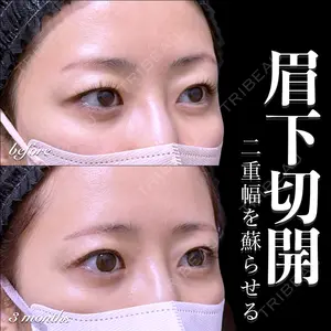 EMMO FACE CLINIC 大宮院 百瀬 直也医師の症例