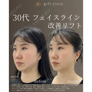 gift clinic 能登谷 翔医師の症例