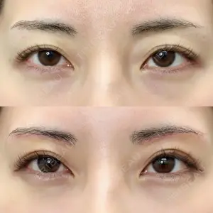 ルラ美容クリニック 札幌本院 早坂 亮哉医師の症例