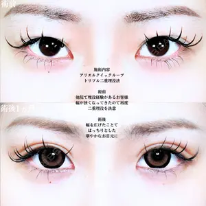 アリエル美容クリニック 大宮院 江郷隼一郎医師の症例