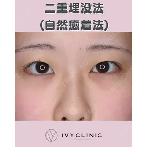 千葉美容外科アイビークリニックの症例
