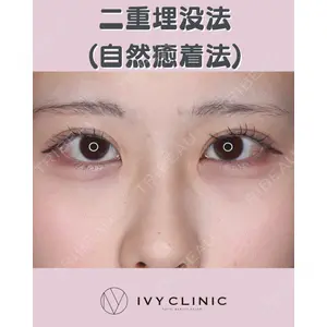 千葉美容外科アイビークリニックの症例
