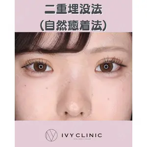 千葉美容外科アイビークリニックの症例