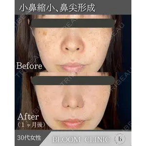 ブルームクリニック（BLOOM CLINIC） 大西 雅樹医師の症例
