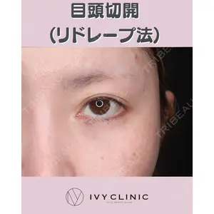 千葉美容外科アイビークリニックの症例