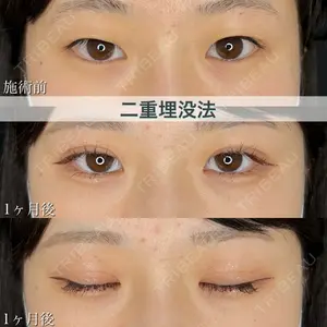 ブルームクリニック（BLOOM CLINIC） 大西 雅樹医師の症例