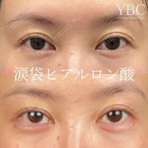 YBC横浜美容外科 池袋院の症例