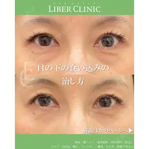 LIBER CLINIC 矢橋 洋一郎医師の症例