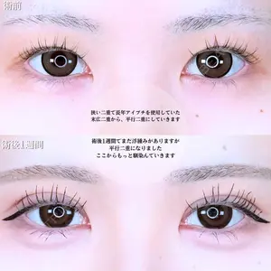 アリエル美容クリニック 水戸院 天白 典秀医師の症例