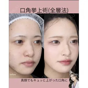 吉祥寺アイビークリニック 巴 窓花医師の症例
