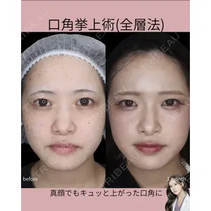吉祥寺アイビークリニック 巴 窓花医師の症例