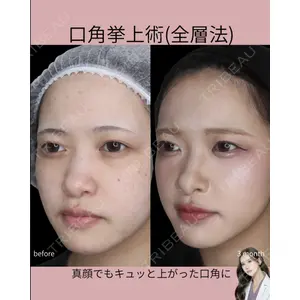 吉祥寺アイビークリニック 巴 窓花医師の症例
