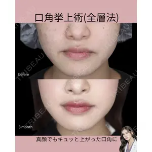 吉祥寺アイビークリニック 巴 窓花医師の症例