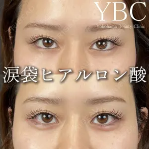 YBC横浜美容外科 立川院 大島 諒士医師の症例