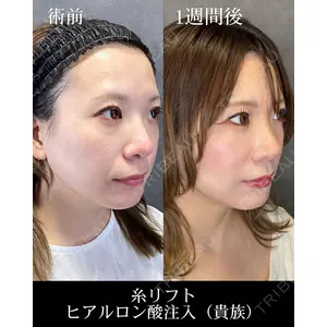 HAAB CLINIC 福岡院 米谷 拓朗医師の症例