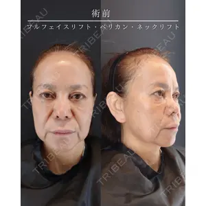 HAAB BEAUTY CLINIC 南青山本院（新院） 小平 佳典医師の症例