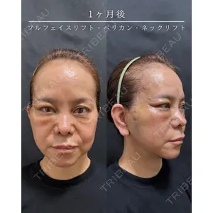 HAAB BEAUTY CLINIC 南青山本院（新院） 小平 佳典医師の症例