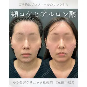 ルラ美容クリニック 札幌本院 田中 瑞希医師の症例
