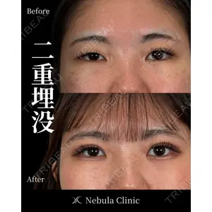 愛知春日井美容外科ネビュラクリニック 都築 諒医師の症例