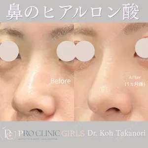 PRO CLINIC プロクリニック 銀座院 洪 嵩典医師の症例