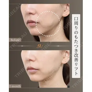 gift clinic 能登谷 翔医師の症例