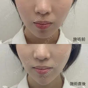 おおたかの森ビューティークリニックthe artの症例