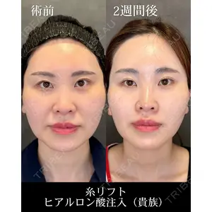 HAAB CLINIC 福岡院 北村 可恋医師の症例